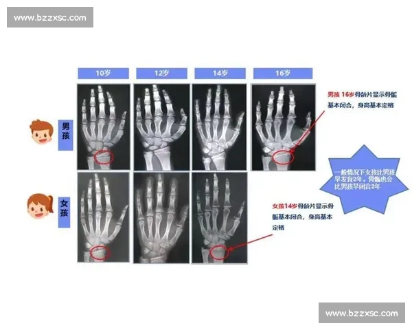 18 岁骨骺线未闭合?科学 3 招助你再长高 5cm 18 岁骨骺线未闭合?科学 3 招助你再长高 5cm